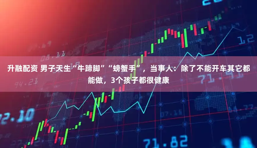 升融配资 男子天生“牛蹄脚”“螃蟹手”，当事人：除了不能开车其它都能做，3个孩子都很健康